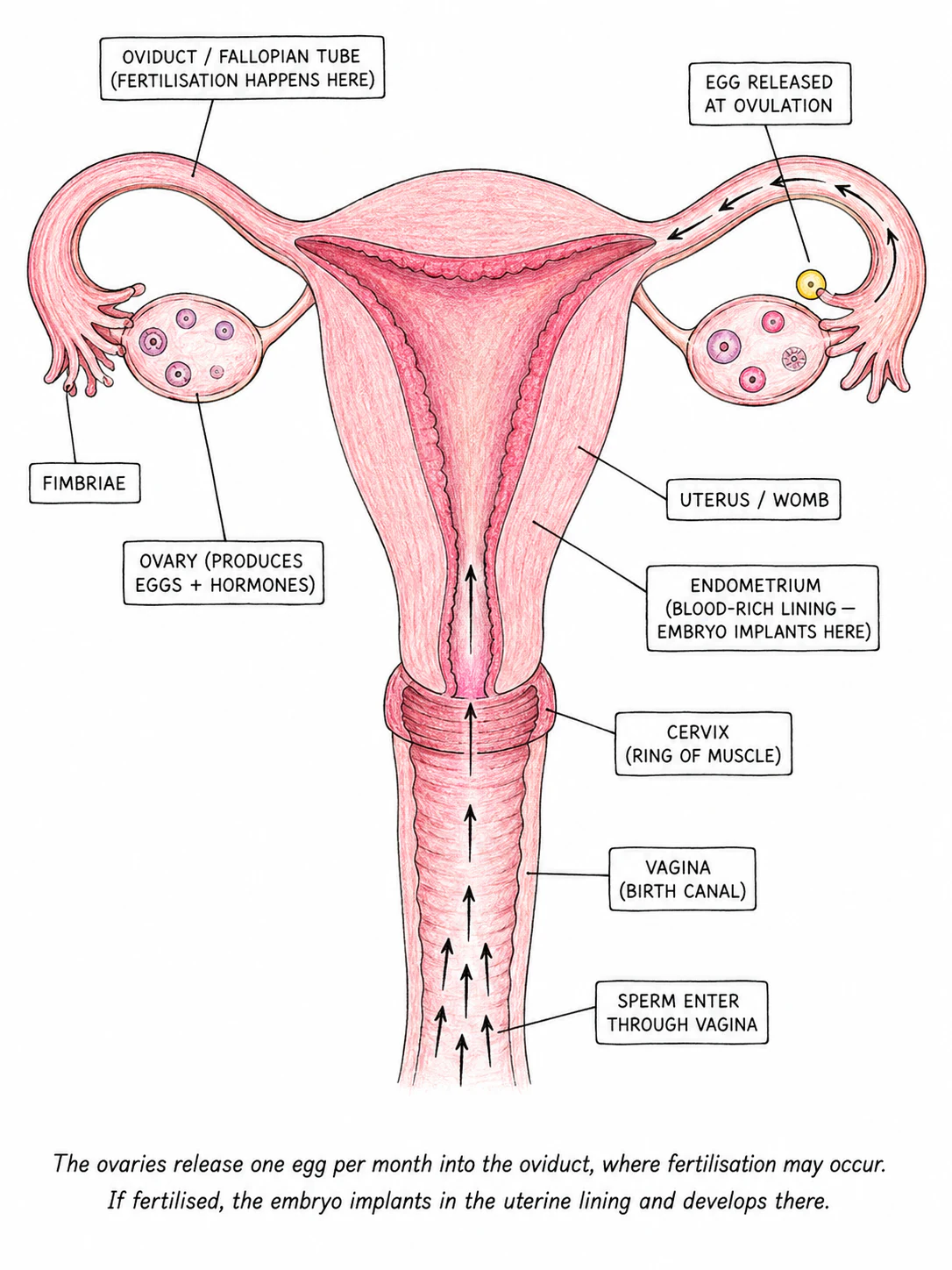 A labelled diagram of the female reproductive system in side view, showing ovaries, oviducts (fallopian tubes), uterus, endometrium, cervix, and vagina