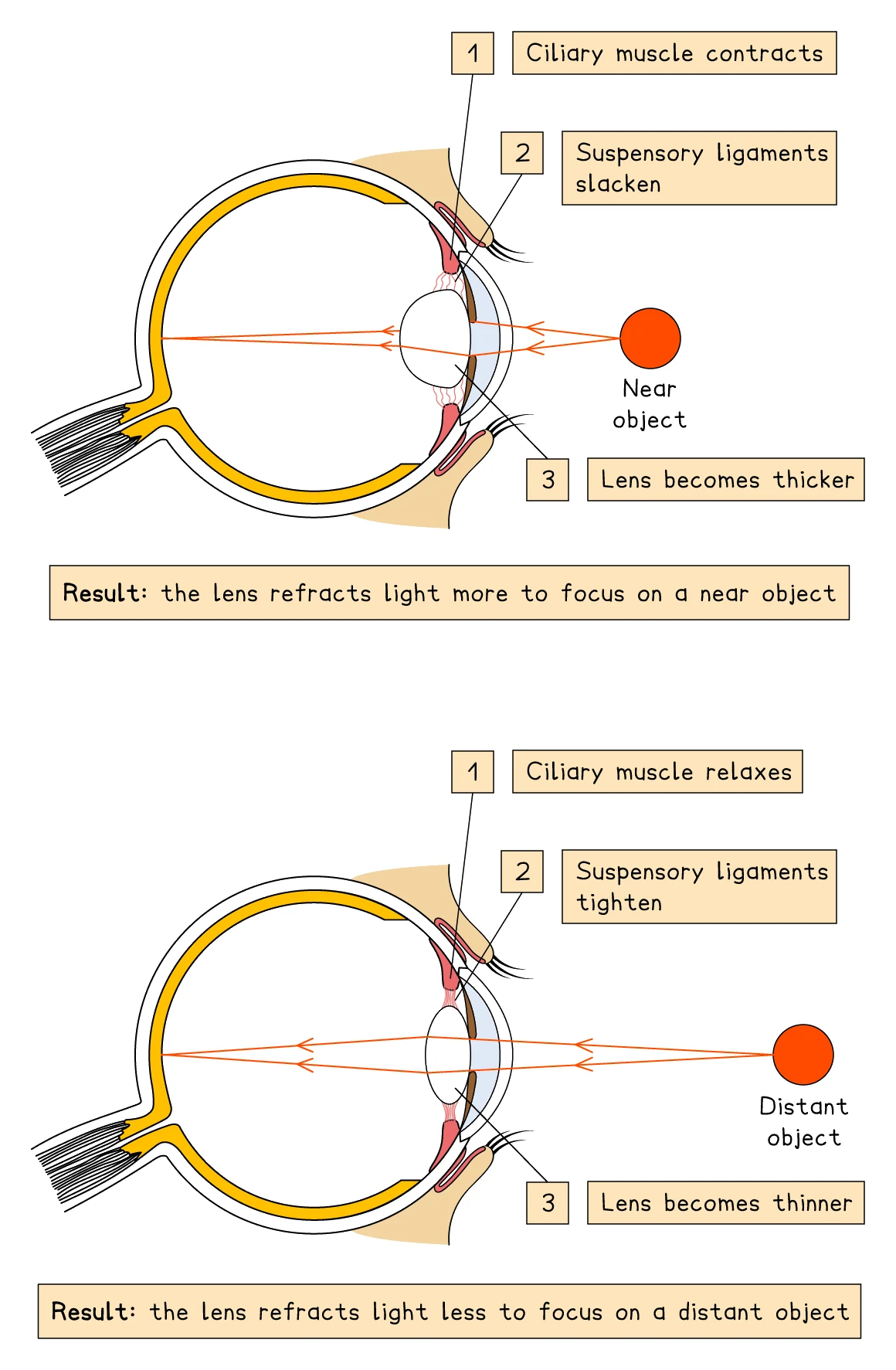 Accommodation in the eye: for a near object the ciliary muscle contracts, the suspensory ligaments slacken and the lens becomes thicker to refract light more; for a distant object the ciliary muscle relaxes, the suspensory ligaments tighten and the lens becomes thinner to refract light less