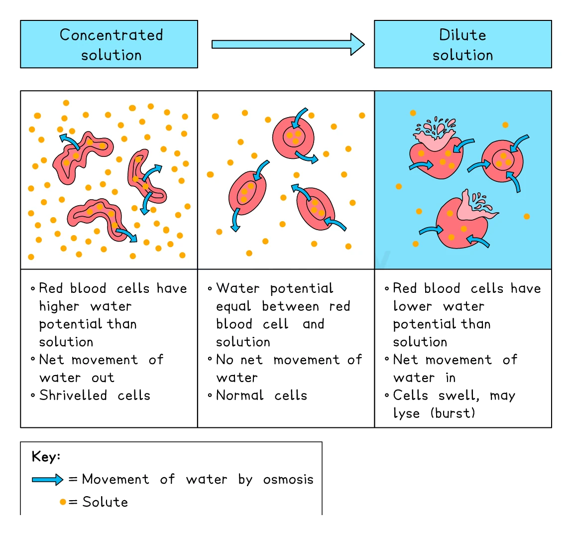 Red blood cells in concentrated solution shrivel as water leaves, stay normal in an equal solution, and swell and burst in a dilute solution as water enters by osmosis